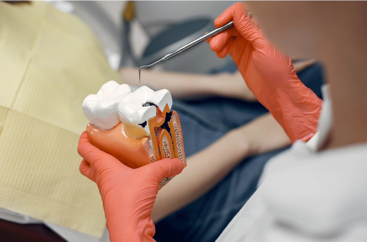 Root Canal Treatment