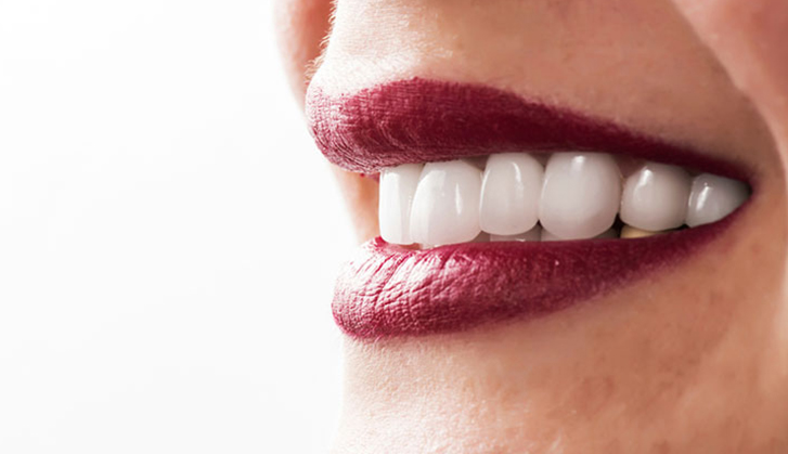 Using Dental Veneers To Restore Your Smile