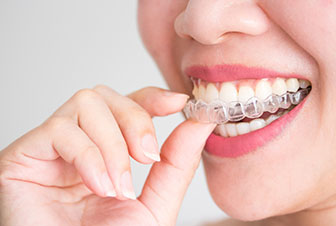 All About Invisalign Treatment