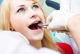 Things to Know Before Wisdom Tooth Extraction