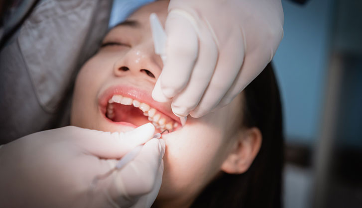 Tooth Extraction Procedure