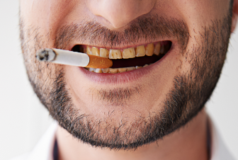 Smoking And Oral Health – All You Need To Know