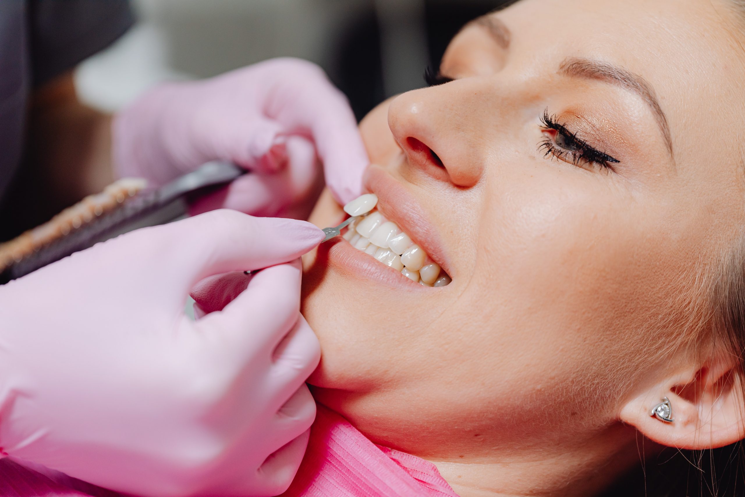 How Cosmetic Dentistry Can Help Boost Your Confidence?