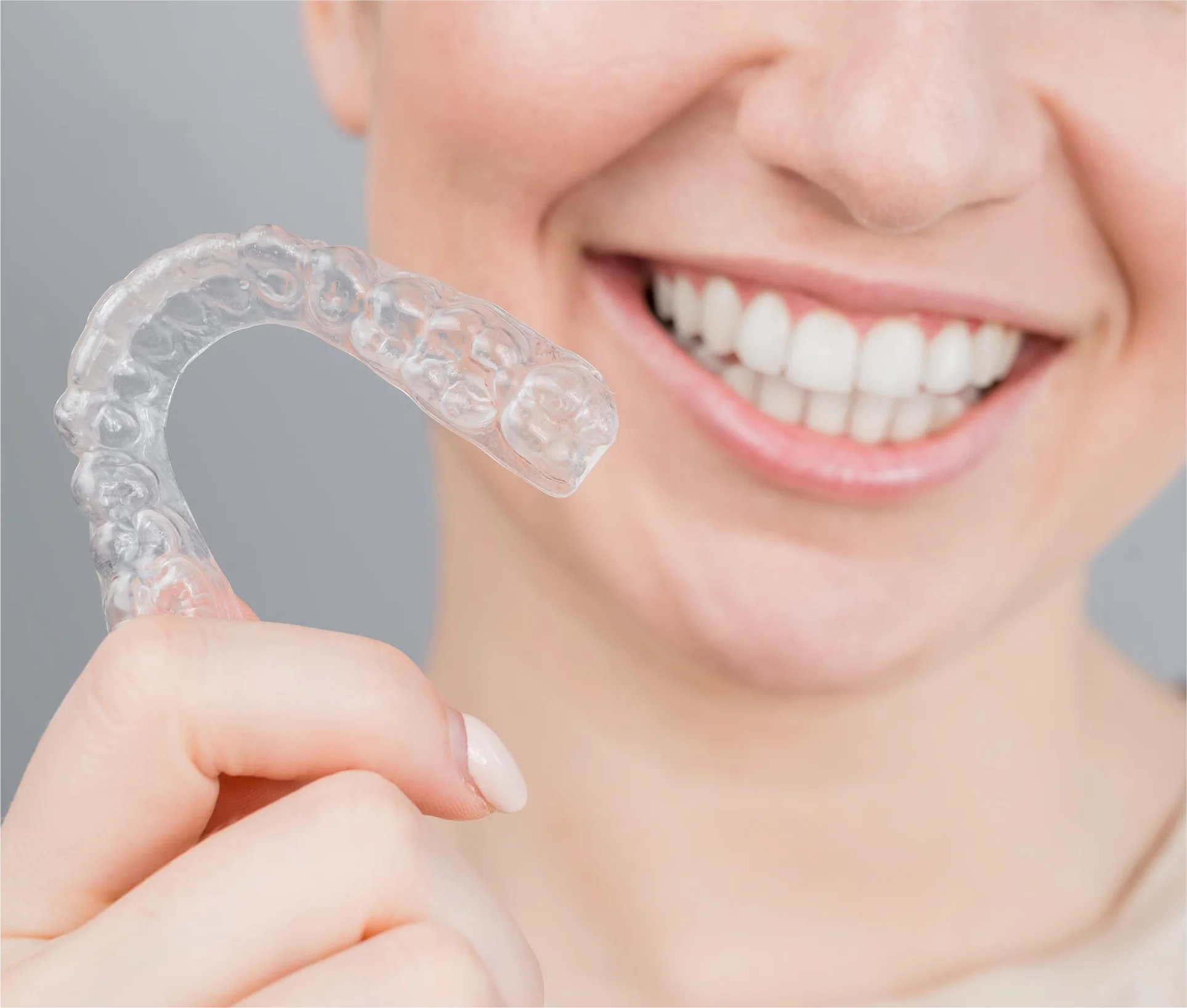 invisalign-clear-aligners