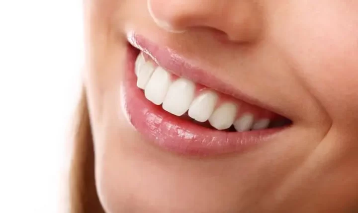 Teeth Whitening: The Impact of Diet and Lifestyle Habits