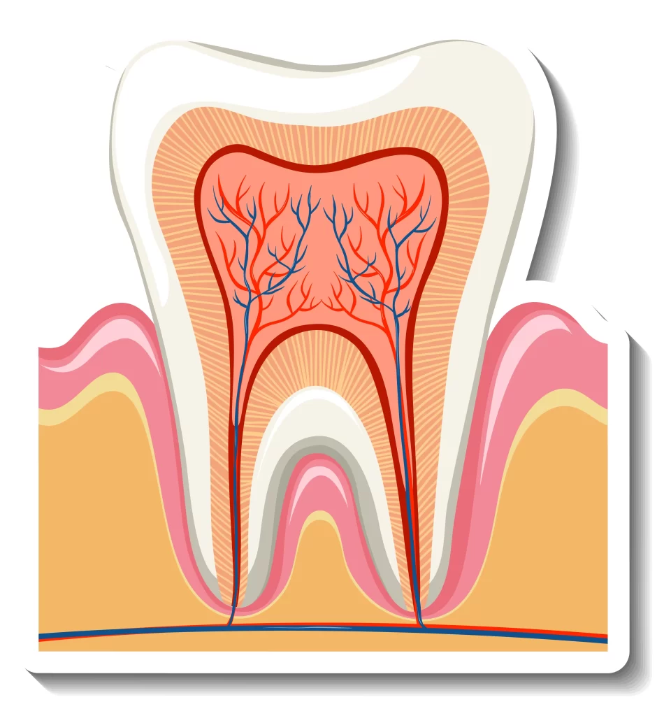 Detailed cross-sectional diagram of a tooth showing enamel, dentin, pulp, and surrounding gum tissues, relevant to guided tissue regeneration techniques.