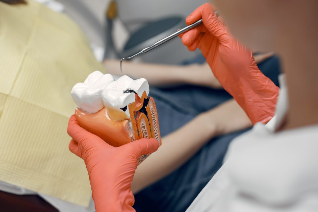 Dentist demonstrating tooth anatomy and root canal process with a model